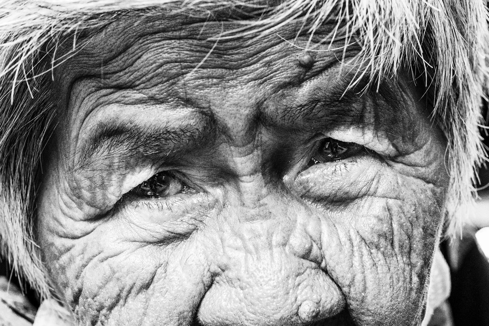 皺紋的開始 - 魚尾紋是什麼？